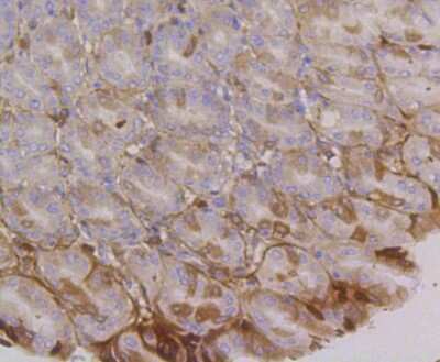 Immunohistochemistry-Paraffin: Integrin alpha 6/CD49f Antibody (SR45-00) [NBP2-67311]