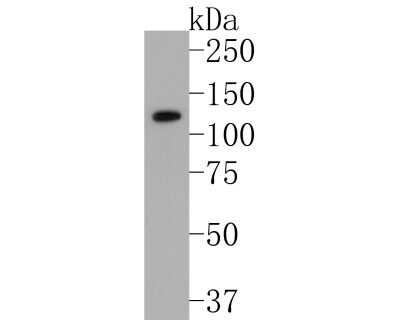 Western Blot: Integrin alpha 6/CD49f Antibody (SR45-00) [NBP2-67311]