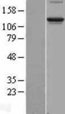 Western Blot: Integrin alpha 6/CD49f Overexpression Lysate [NBL1-12066]