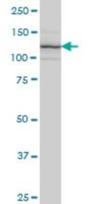 Western Blot: Integrin alpha 7 Antibody (8G2) [H00003679-M01]