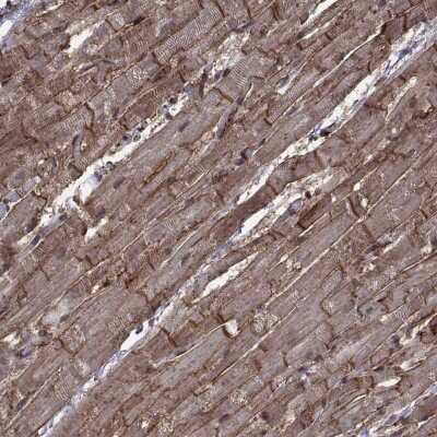 Immunohistochemistry-Paraffin: Integrin alpha 7 Antibody [NBP1-86118]