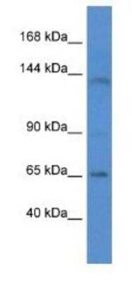 Western Blot: Integrin alpha 7 Antibody [NBP1-74207]