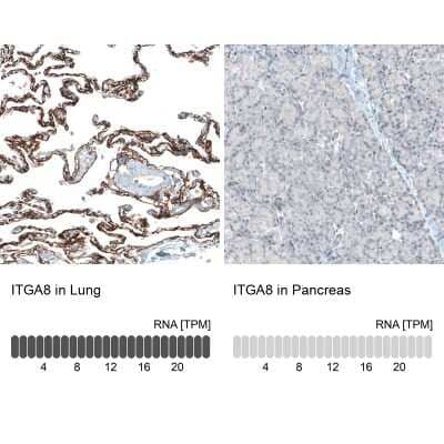 Immunohistochemistry-Paraffin: Integrin alpha 8 Antibody (CL7304) [NBP2-76482]