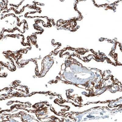 Immunohistochemistry-Paraffin: Integrin alpha 8 Antibody (CL7304) [NBP2-76482]