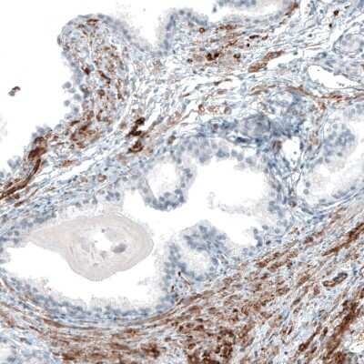Immunohistochemistry-Paraffin: Integrin alpha 8 Antibody (CL7304) [NBP2-76482]
