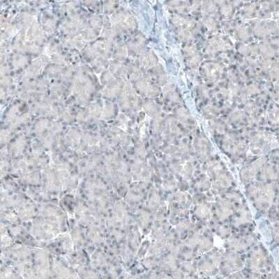 Immunohistochemistry-Paraffin: Integrin alpha 8 Antibody (CL7304) [NBP2-76482]