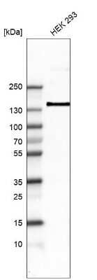 Western Blot: Integrin alpha 8 Antibody (CL7304) [NBP2-76482]