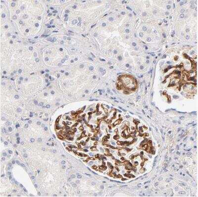Immunohistochemistry-Paraffin: Integrin alpha 8 Antibody [NBP1-86519]