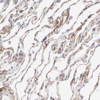 Immunohistochemistry-Paraffin: Integrin alpha 8 Antibody [NBP1-86519]