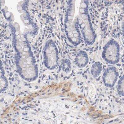 Immunohistochemistry-Paraffin: Integrin alpha 8 Antibody [NBP1-86519]