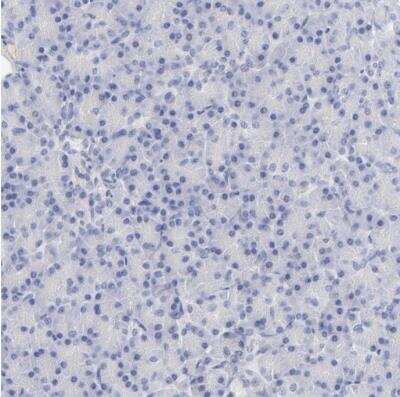 Immunohistochemistry-Paraffin: Integrin alpha 8 Antibody [NBP1-86519]