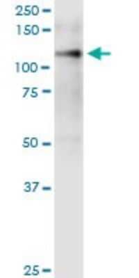 Western Blot: Integrin alpha 9 Antibody (3E4) [H00003680-M01]