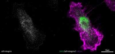 Immunocytochemistry/ Immunofluorescence: Integrin alpha 9 Antibody [NBP2-16972]