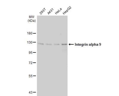 Western Blot: Integrin alpha 9 Antibody [NBP2-16972]