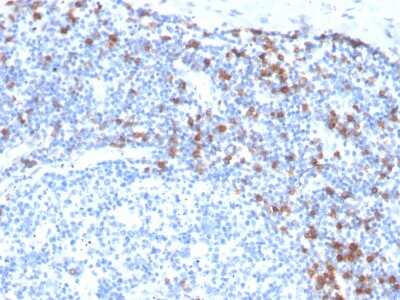 Immunohistochemistry-Paraffin: Integrin alpha E/CD103 Antibody (ITGAE/3904R) - Azide and BSA Free [NBP3-08855]