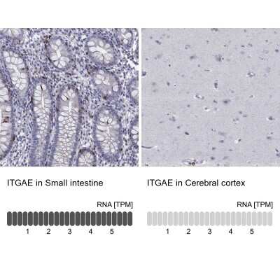 Immunocytochemistry/ Immunofluorescence: Integrin alpha E/CD103 Antibody [NBP3-16987]