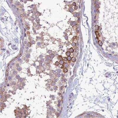 Immunohistochemistry-Paraffin: Integrin alpha E/CD103 Antibody [NBP1-88142]