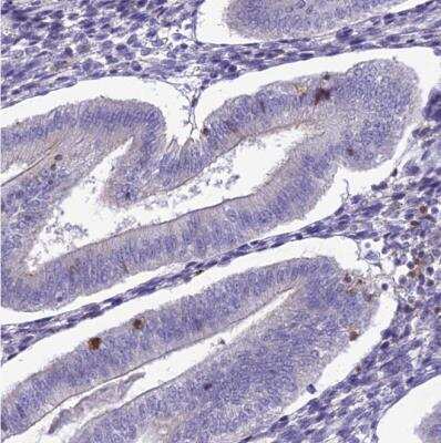 Immunohistochemistry-Paraffin: Integrin alpha E/CD103 Antibody [NBP1-88142]