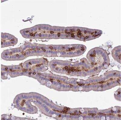 Immunohistochemistry-Paraffin: Integrin alpha E/CD103 Antibody [NBP1-88142]