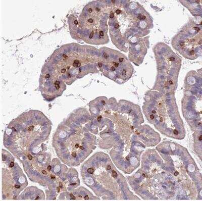 Immunohistochemistry-Paraffin: Integrin alpha E/CD103 Antibody [NBP1-88142]