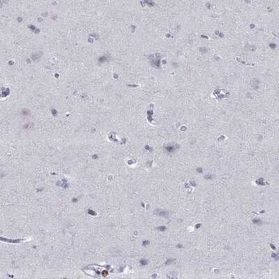 Immunohistochemistry-Paraffin: Integrin alpha E/CD103 Antibody [NBP3-16987]