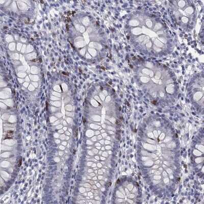 Immunohistochemistry-Paraffin: Integrin alpha E/CD103 Antibody [NBP3-16987]