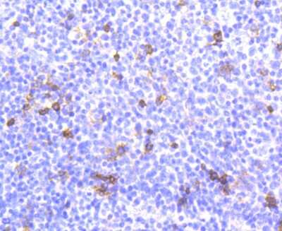 Immunohistochemistry-Paraffin: Integrin alpha E/CD103 Antibody (SN62-06) [NBP2-67663]