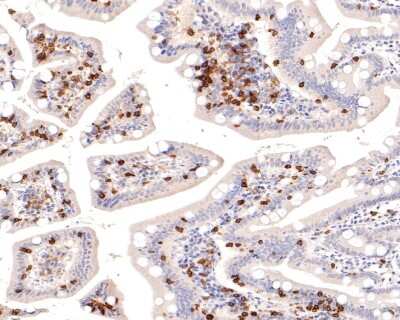 Immunohistochemistry-Paraffin: Integrin alpha E/CD103 Antibody (SN62-06) [NBP2-67663]