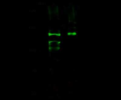 Western Blot: Integrin alpha E/CD103 Antibody [NBP2-98926]