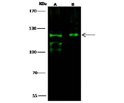 Western Blot: Integrin alpha E/CD103 Antibody [NBP2-98926]