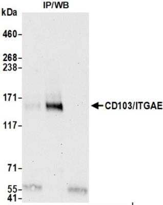 Immunoprecipitation: Integrin alpha E2/Dendritic Cells Antibody (BLR171J) [NBP3-14689]