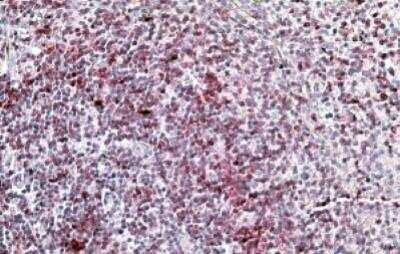 Immunohistochemistry-Paraffin: Integrin alpha L/CD11a Antibody [NBP1-51967]