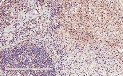 Immunohistochemistry-Paraffin: Integrin alpha L/CD11a Antibody [NBP1-51967]