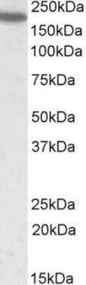 Western Blot: Integrin alpha L/CD11a Antibody [NBP1-51967]