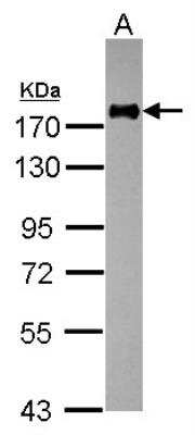 Western Blot: Integrin alpha L/CD11a Antibody [NBP2-14902]