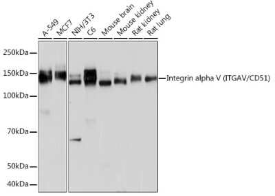 Western Blot: Integrin alpha V/CD51 Antibody (10T9N2) [NBP3-15647]