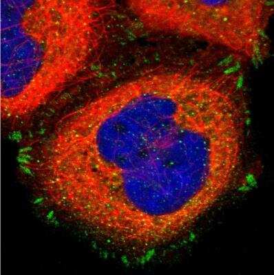 Immunocytochemistry/ Immunofluorescence: Integrin alpha V/CD51 Antibody [NBP1-85746]