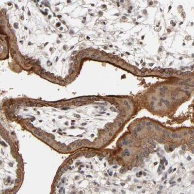 Immunohistochemistry-Paraffin: Integrin alpha V/CD51 Antibody [NBP1-85746]