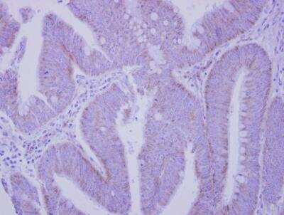 Immunohistochemistry-Paraffin: Integrin alpha V/CD51 Antibody [NBP2-16973]