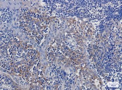Immunohistochemistry-Paraffin: Integrin alpha V/CD51 Antibody (S03-6E3) [NBP3-19510]