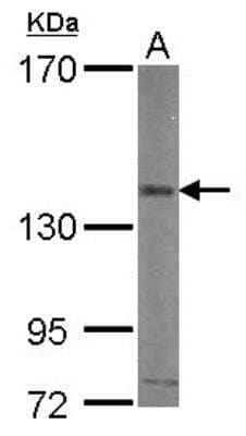 Western Blot: Integrin alpha V/CD51 Antibody [NBP2-16973]