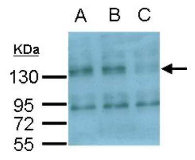 Western Blot: Integrin alpha V/CD51 Antibody [NBP2-16973]