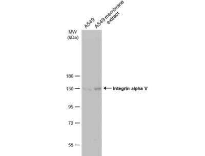 Western Blot: Integrin alpha V/CD51 Antibody [NBP2-16973]