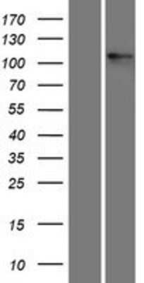 Western Blot: Integrin alpha V/CD51 Overexpression Lysate [NBP2-11354]