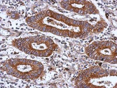 Immunohistochemistry-Paraffin: Integrin beta 1/CD29 Antibody [NBP2-16974]