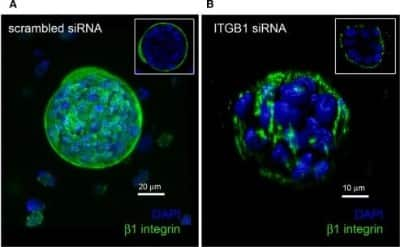 Immunocytochemistry/ Immunofluorescence: Integrin beta 1/CD29 Antibody (12G10) - BSA Free [NB100-63255]