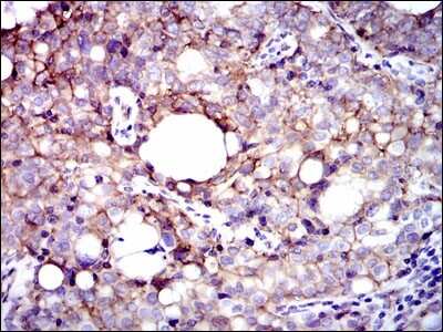 Immunohistochemistry-Paraffin: Integrin beta 1/CD29 Antibody (3B6) - BSA Free [NBP2-22191]