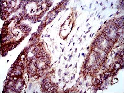 Immunohistochemistry-Paraffin: Integrin beta 1/CD29 Antibody (3B6) - BSA Free [NBP2-22191]