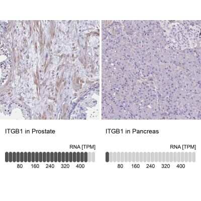 Immunohistochemistry-Paraffin: Integrin beta 1/CD29 Antibody [NBP2-62630]