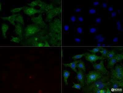 Immunocytochemistry/ Immunofluorescence: Integrin beta 1/CD29 Antibody (P4C10) - Azide and BSA Free [NBP2-80818]